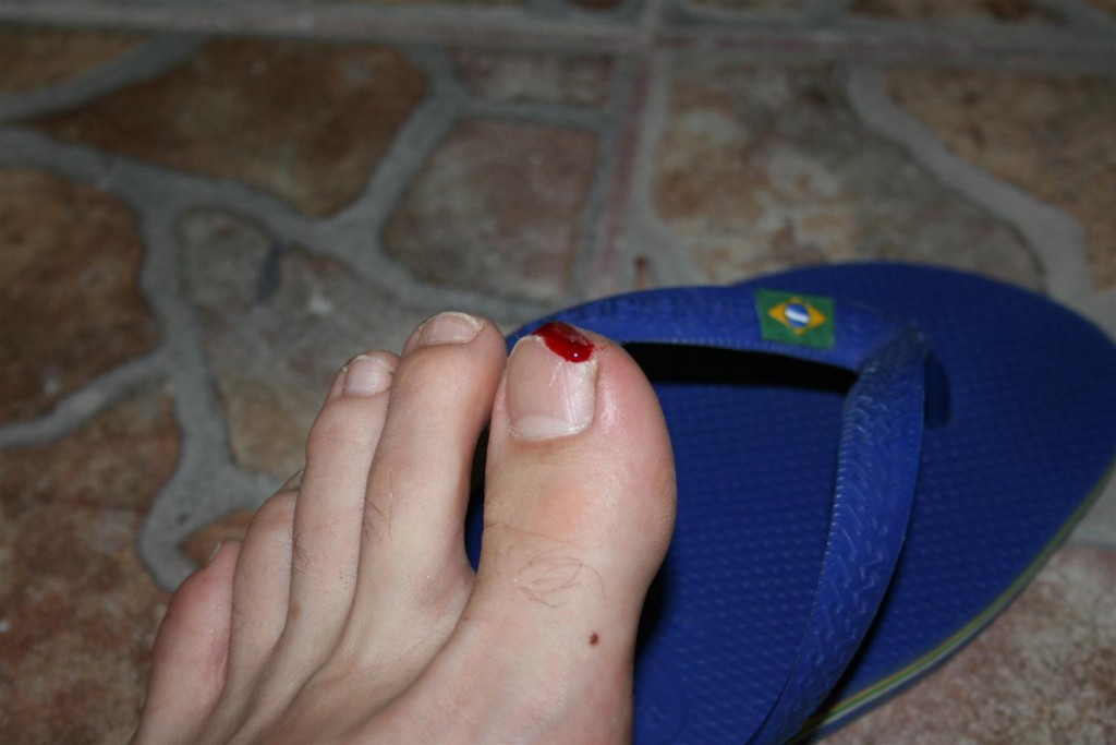 Cobblestones can be hard teachers